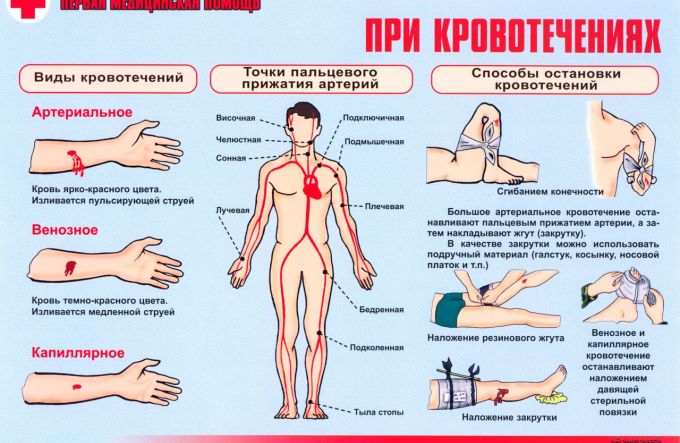 Описание: https://www.infoport.live/wp-content/uploads/2017/09/pri-krovotecheniyah-1.jpg