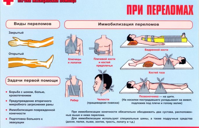 Описание: https://www.infoport.live/wp-content/uploads/2017/09/pri-perelomah-1.jpg